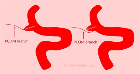 abcomm meaning